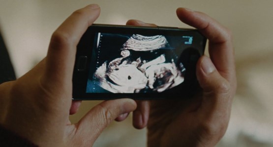 En ultraljudsbild syns på skärmen på en mobil.