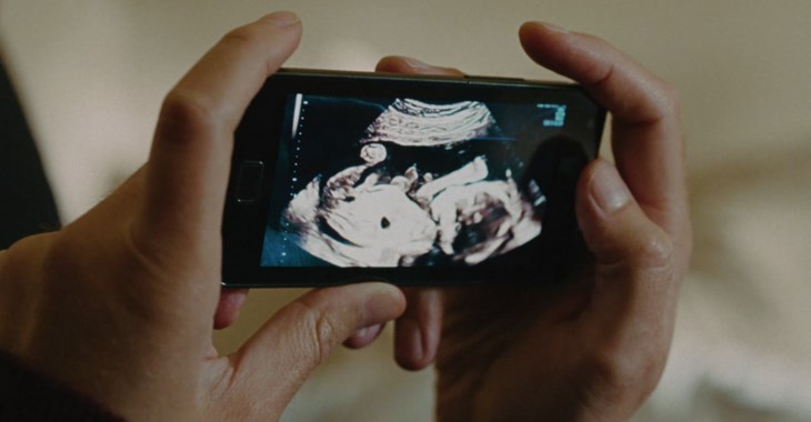 Två händer som håller i en telefon som visar en ultraljudsbild.